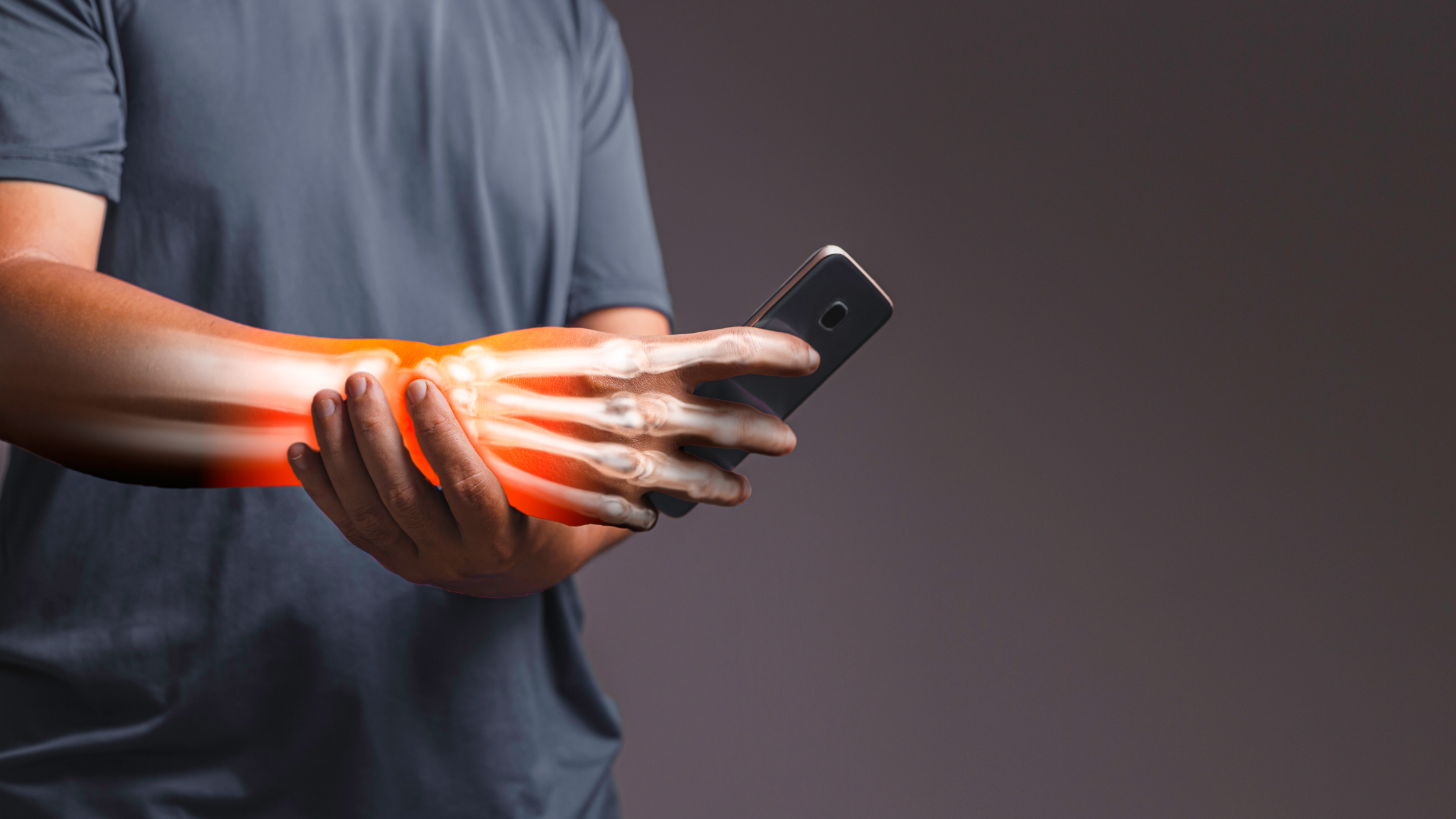 complex regional pain syndrome