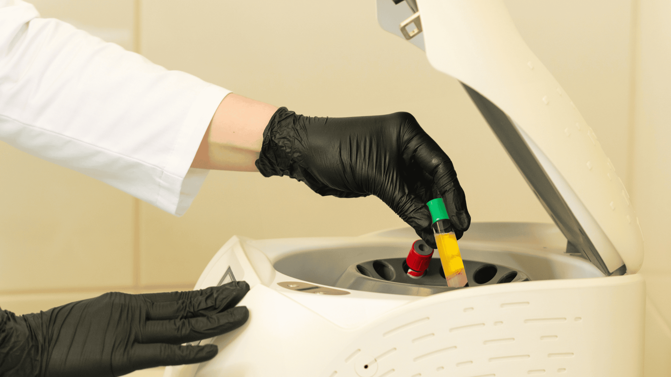 PRP therapy for joint pain