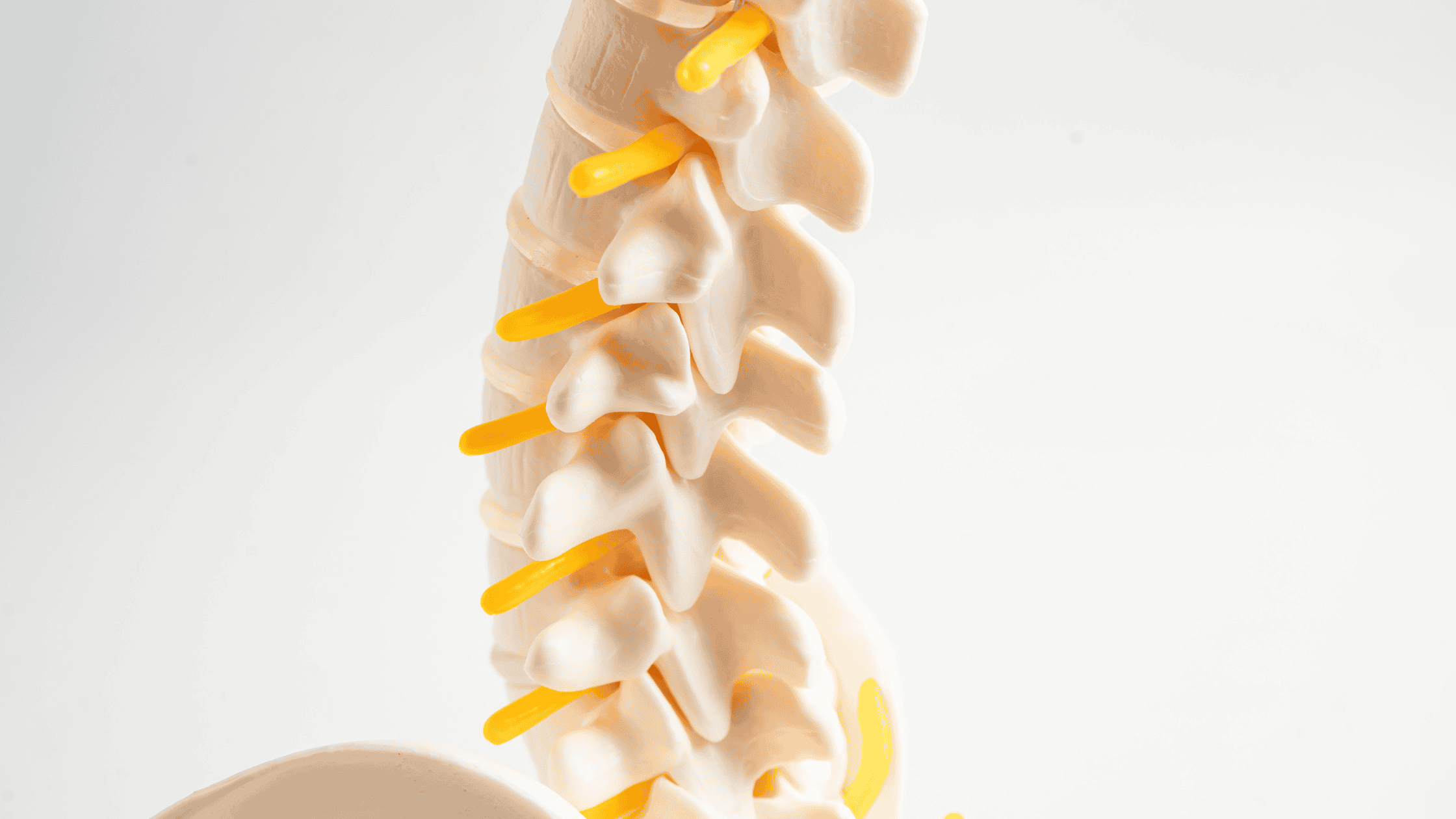 spinal cord stimulation